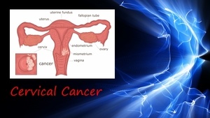 Cervical Cancer Frequency Healing - Rife Frequencies and More